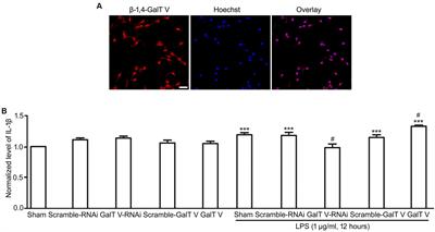 The Impact of β-1,4-Galactosyltransferase V on Microglial Function